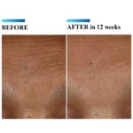 Skinceuticals Hyaluronic Acid Intensifier (H.A.) 30 ml