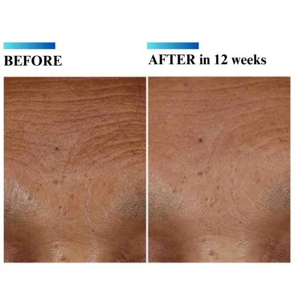 Skinceuticals Hyaluronic Acid Intensifier (H.A.) 30 ml