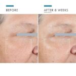 SkinCeuticals Eye Cream 15ml – Reduce Dark Circles, Puffiness & Fine Lines Fast