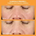 Paula's Choice BOOST C15 Super Booster, 15% Vitamin C with Vitamin E & Ferulic Acid 0.67 Ounces