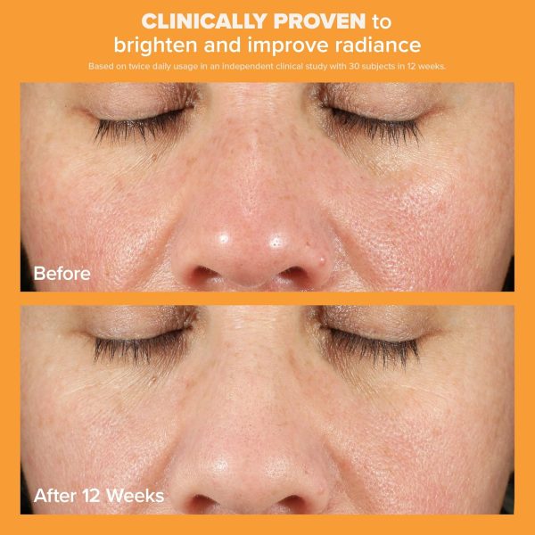 Paula's Choice BOOST C15 Super Booster, 15% Vitamin C with Vitamin E & Ferulic Acid 0.67 Ounces