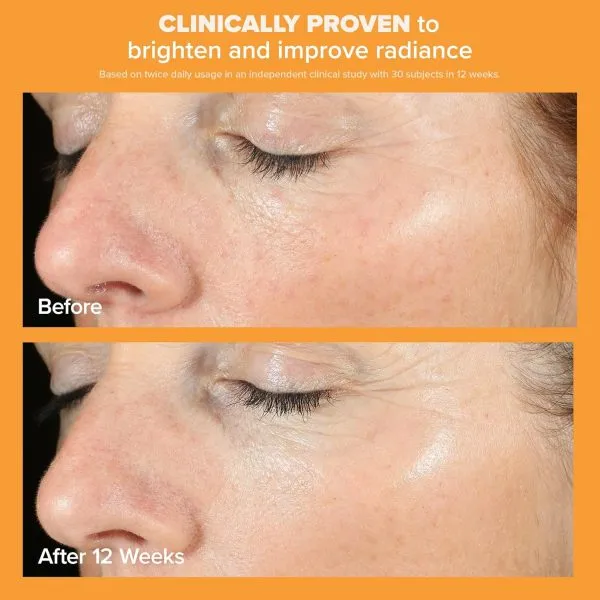 Paula's Choice BOOST C15 Super Booster, 15% Vitamin C with Vitamin E & Ferulic Acid 0.67 Ounces